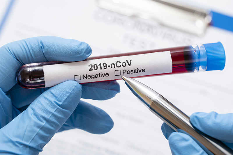 Nosečnost koronavirus test