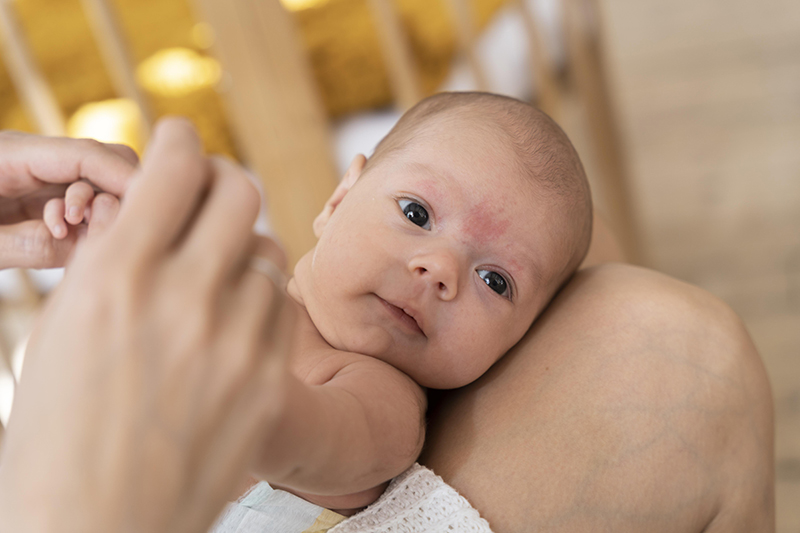 Bábätko a vyrážka