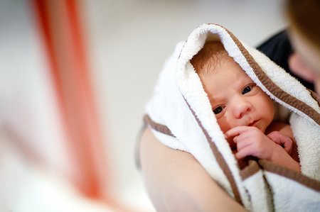 Kaj je zlatenica pri novorojenčkih in ali se je moramo bati?