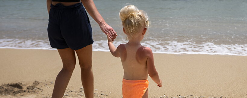 Como proteger a pele das crianças nas maiores ondas de calor?